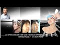 Le lifting malaire cest quoi  quelles differences avec le lifting cervico facial dr j buis  paris