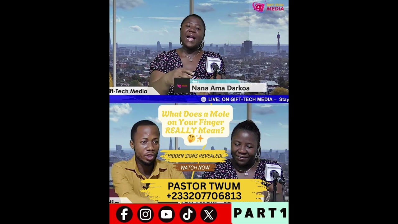 Finger Mole Secrets EXPOSED! 🤯 What It Says About Your Destiny (PART 1)