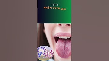Top 10 dấu hiệu CẢNH BÁO sớm bệnh tiểu đường #benhtieuduong #SucKhoe #DauHieuBenh #ChamSocSucKhoe
