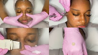 Summer Glow Facial w\/ Microdermabrasion | GlamByLiaLeigh