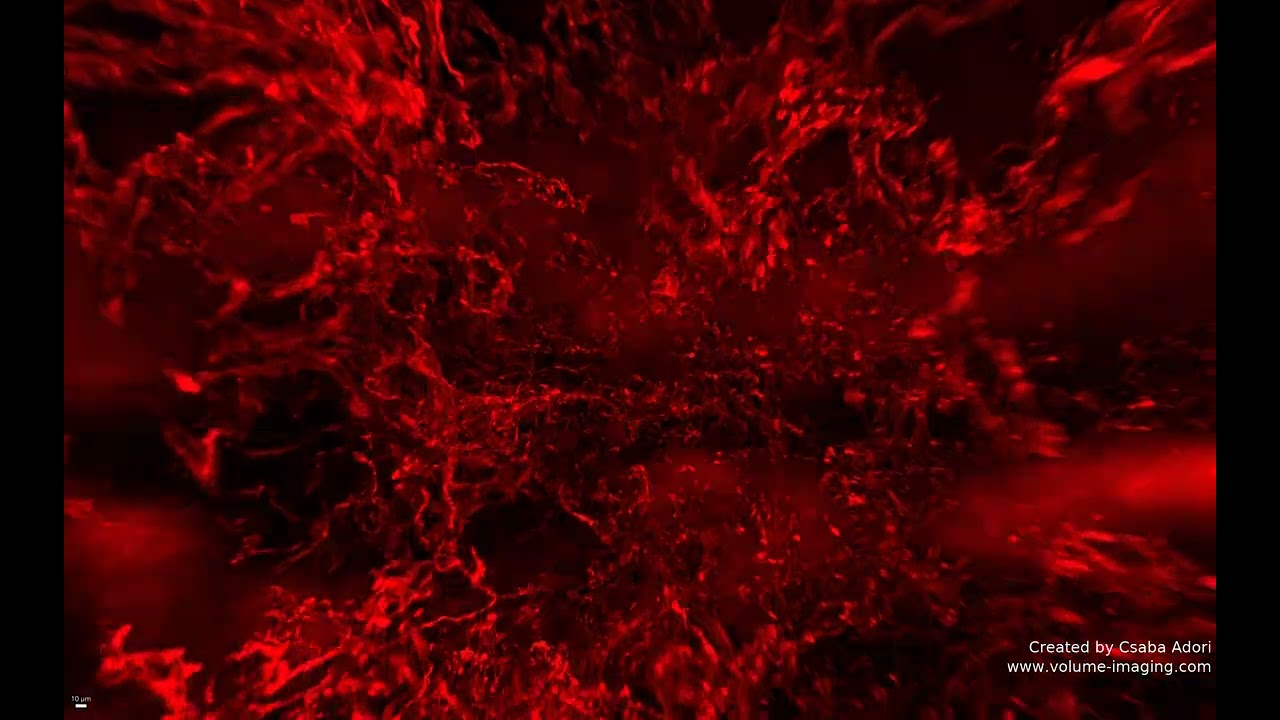 3D volume imaging - PLACENTA MOVIE 2