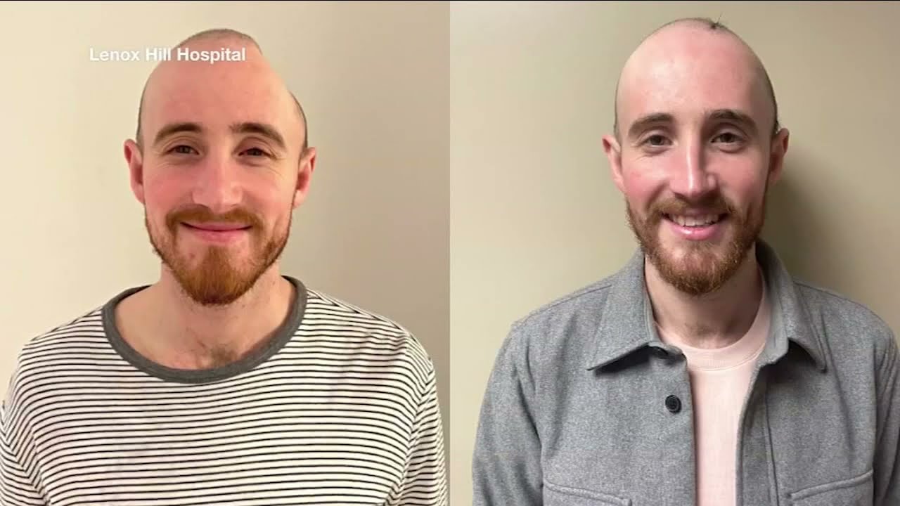 NY's 1st neuroplastic program saves lives without life-altering scars