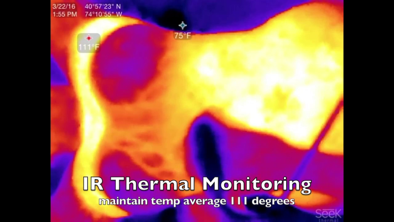 Venus Freeze Thermal Body Contouring Abdomen Thermal Monitoring