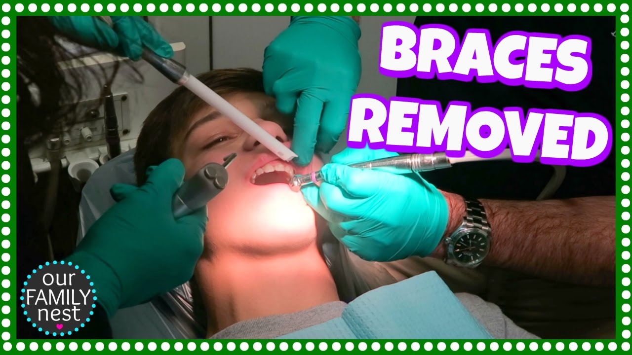 GETTING HIS BRACES REMOVED // HOW DO HIS TEETH LOOK?