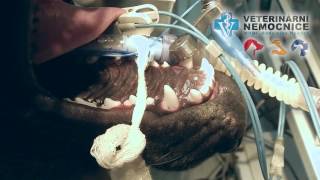 Provedení plomby frakturovaného zubu