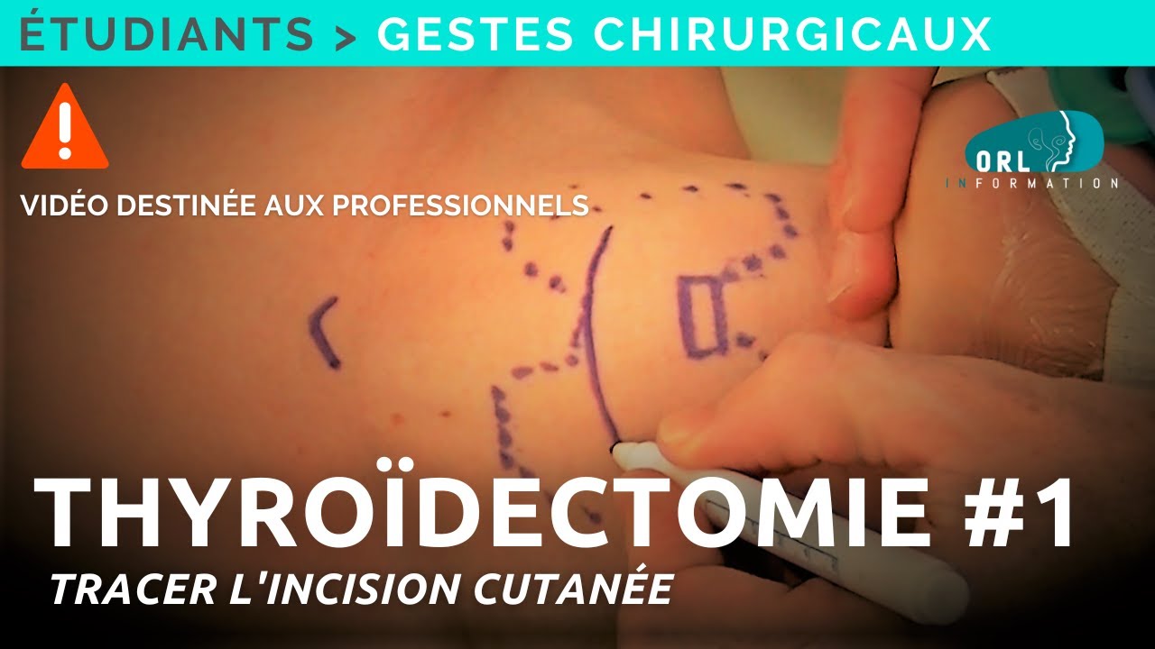 Comment réaliser une thyroïdectomie | #1 Tracer l'incision cutanée | Formation chirurgie ORL