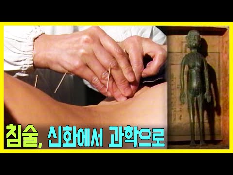 한방기행 중국의학 3000년 제1부 베일벗는 침술 (KBS_1990.01.31.방송)