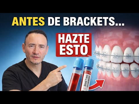 ¡NO te pongas brackets sin estos 5 exámenes!