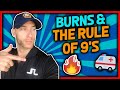 Burns & Rule of 9's Review for EMT's (Burn Patients in EMS)