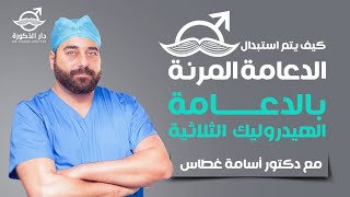 تركيب الدعامة الهيدروليك الثلاثية لانتصاب قوي  |(عملية استبدال)| مع الدكتور اسامة غطاس