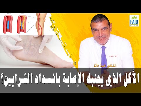 الأكل الذي يجنبك الإصابة بانسداد الشرايين الدكتور الفايد  الأكل الذي يجنبك الإصابة بانسداد الشرايين الدكتور الفايد