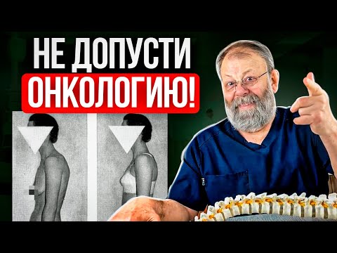 Видео: Може ли пролапсът да причини запек?