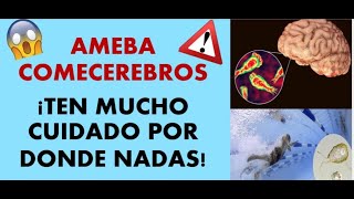 Naegleria Fowleri: La ameba comecerebros 🧠☠️