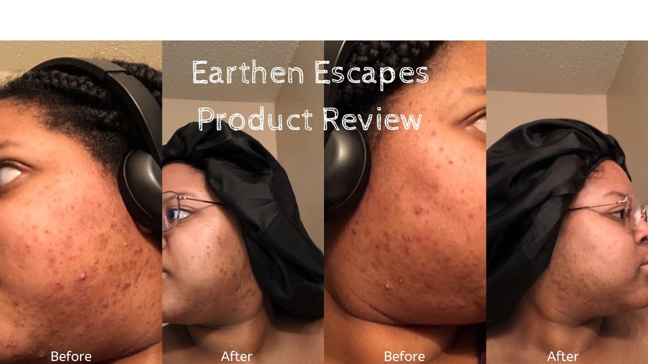 Earthen Escapes Dark Spot Corrector
