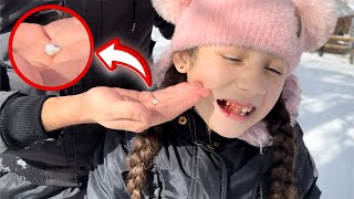 Suri KNOCKED Her Tooth OUT!! *PAINFUL* | Jancy Family