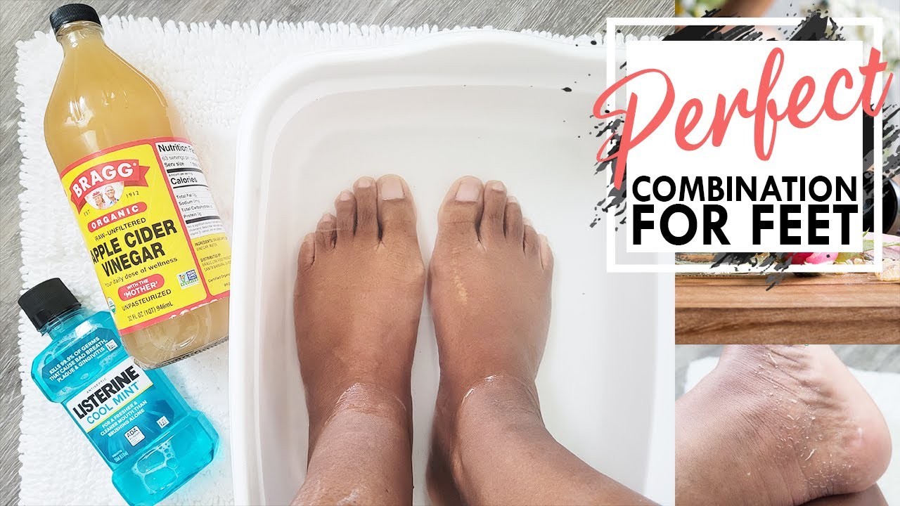 What Is a Vinegar Foot Soak (and How Can You Do One at Home)?