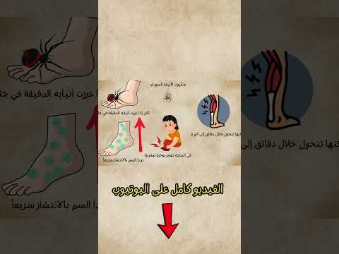 ماذا يحدث إذا لسعتك الأرملة السوداء