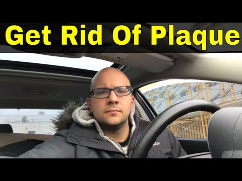 ¿Cómo deshacerse de la placa natural 5 pasos sencillos