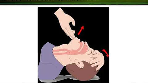 Unit 3 Disaster Medical Operation Part 1 PowerPoint with Narrative