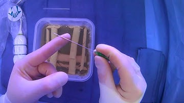 Holding The Micropuncture Needle