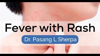 Fever with rash | API | Medical Conference | Dr. Pasang L Sherpa