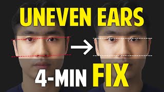 Fix Uneven Earsfacial Asymmetry Correctionbalancing Exercises