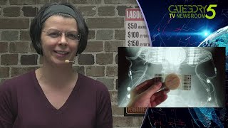 Mind Reading Brain Implant Converts Thought to Speech