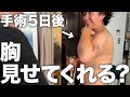 【※閲覧注意】胸オペ5日後のリアルな状態お届けします【術後】
