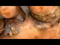 Gladys’s right foot juicy clear jiggers - watch full video and 1000s more @riseupsociety.net