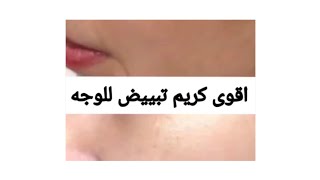 @وصفه طبيعيه لتبييض الوجه والقضاء علي التصبغات والنتيجه من اول اسبوع؟