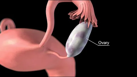 Ovarian Cancer - DayDayNews