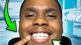 TEMU GOT MY TEETH DONE **GONE WRONG😡**