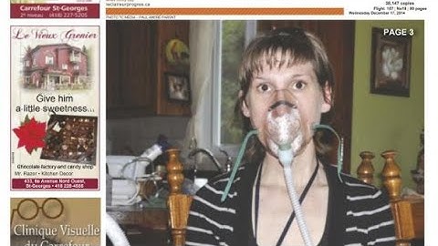 Empty Nose Syndrome & Turbinectomy Risks – A Patient’s Story & Her Warnings