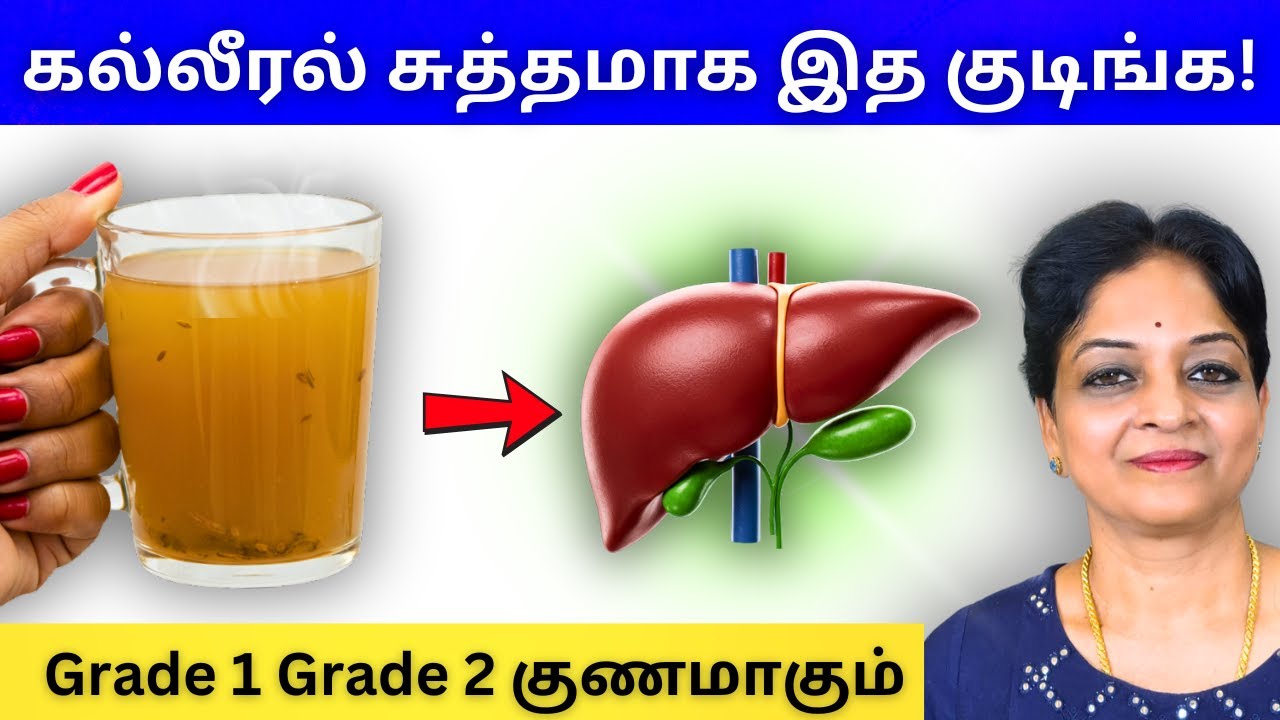 Fatty Liver க்கு மாத்திரை தேவையில்லை! | Tamil Health Tips