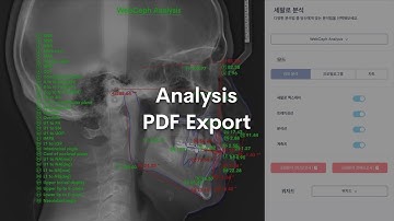 WebCeph: Analysis PDF Export