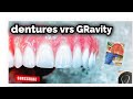 Dentures vrs Gravity