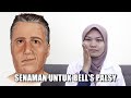 Senaman Muka Bell's Palsy