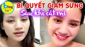 Hướng dẫn cách chăm sóc mắt sau khi cắt mí mau lành và lên dáng đẹp