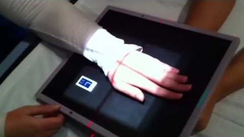 Xray - Wrist (Stecher Method)