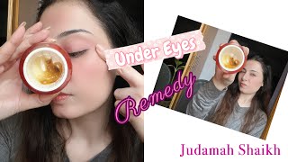 Remove Dark Circles Permanently in 1 Week (Best Home Remedy)