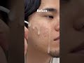 980円で革命起きる？？🔥🔥🔥ekamチャレンジ1週間💪🏻 #skincare #美容 #メンズ美容 #購入品紹介 #pr