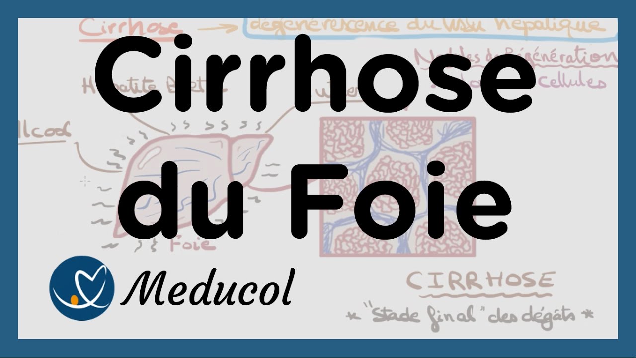 Cirrhose du foie: symptômes et fibrose du foie