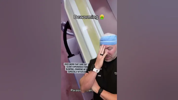 Parasite Cleanse Anyone? 🤮 #shorts