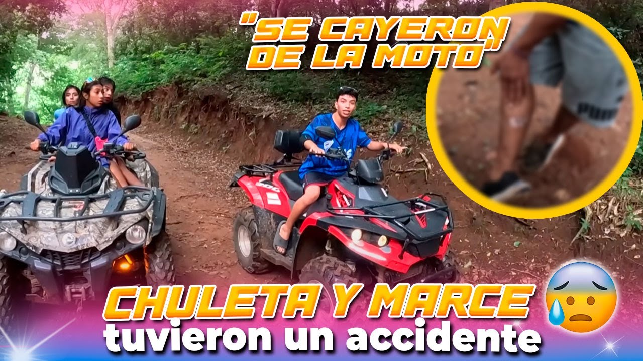 Mira como le quedo la pierna a Chuleta😳😳 Marcela y chuleta se cayeron de la moto 😬😬