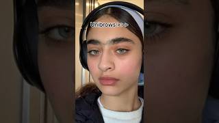 Exploring Eyebrow Styles Separate Eyebrows vs Unibrows - What's the Difference#viral #medical screenshot 3