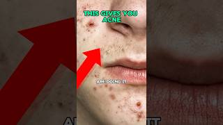 Skin care products give you acne ?