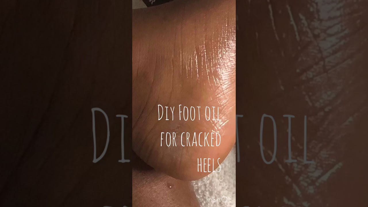 DIY Foot Oil for Cracked Heels (easy ingredients list for lockdown)