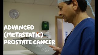 About Advanced (Metastatic) Prostate Cancer