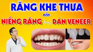 Niềng Răng Hay Dán Sứ Veneer Khi Bị Răng Thưa? | Nam Bùi Vinalign