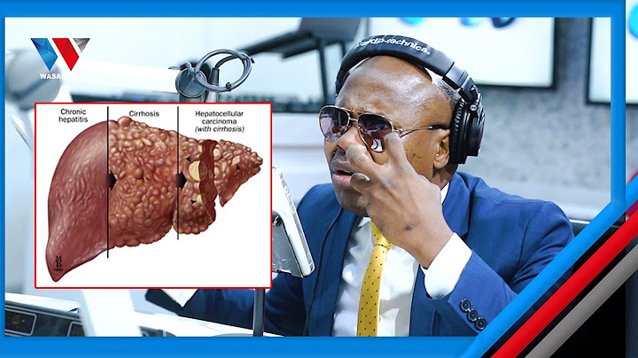 HATARI..! HOMA YA INI TISHIO/DALILI ZAKE HIZI HAPA